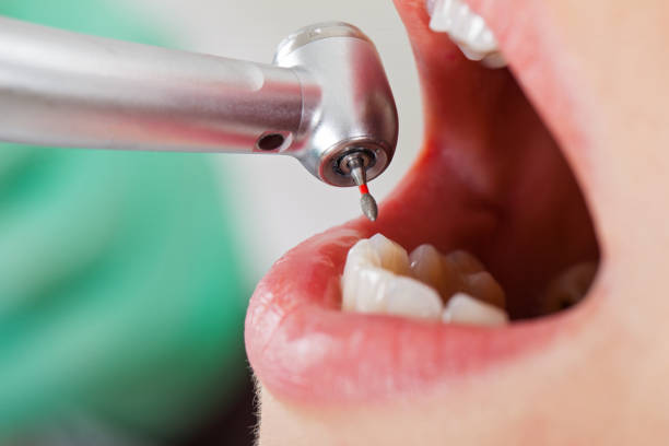 Best Cosmetic Emergency Dentistry in Stlman Valley, IL